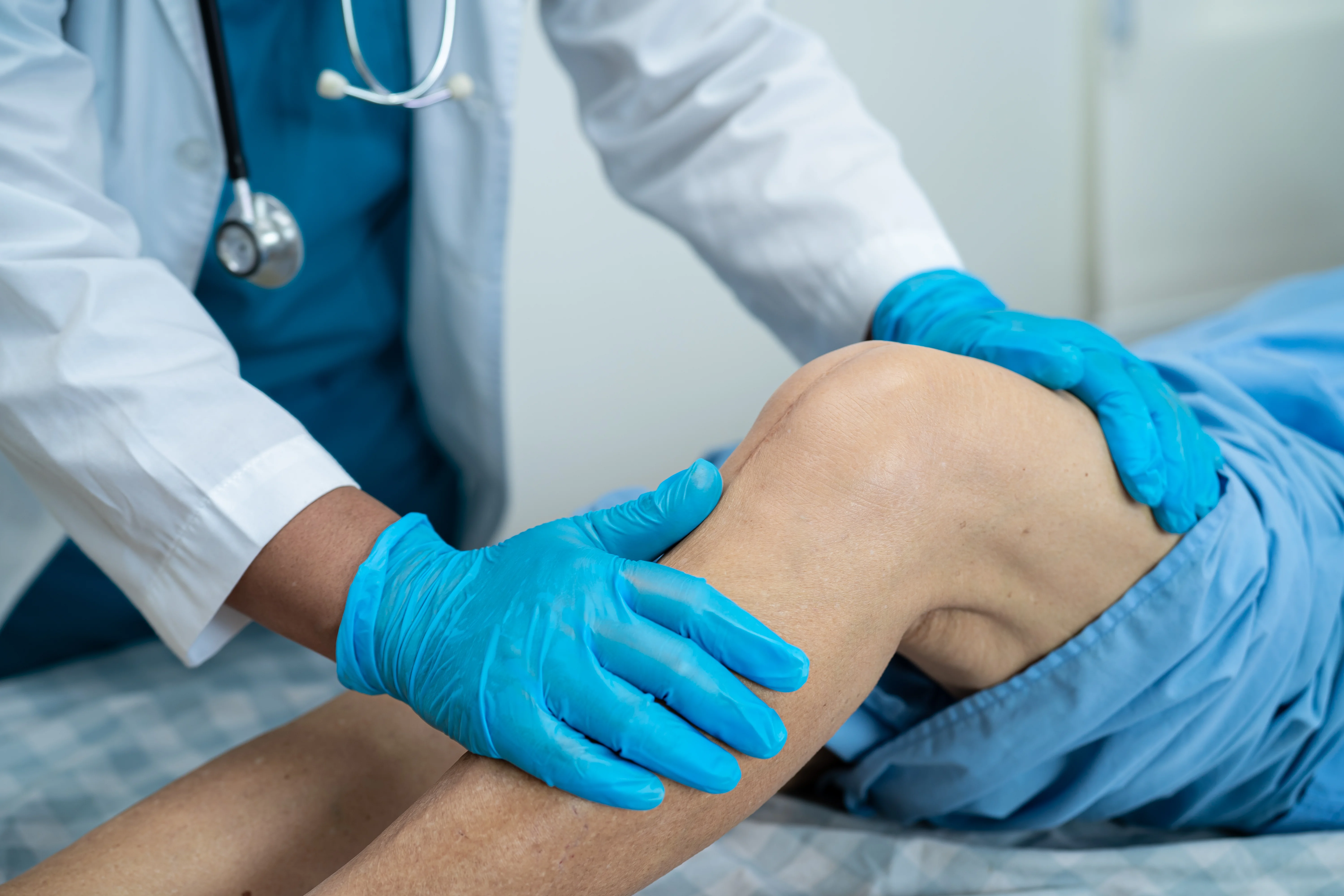 TOTAL KNEE REPLACEMENT SURGERY